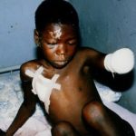 Génocide contre les Bahutu du Burundi de 1988 : 150.000 victimes à NTEGA - MARANGARA