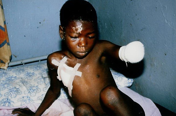 Génocide contre les Bahutu du Burundi de 1988 : 150.000 victimes à NTEGA – MARANGARA